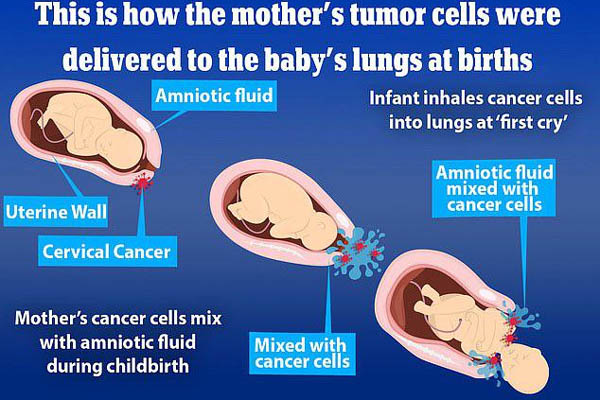 Tác giả vũ điệu rửa tay” phòng chống COVID-19 nổi tiếng Việt Nam không bước được xuống giường vì không điều trị bệnh này sớm-5
