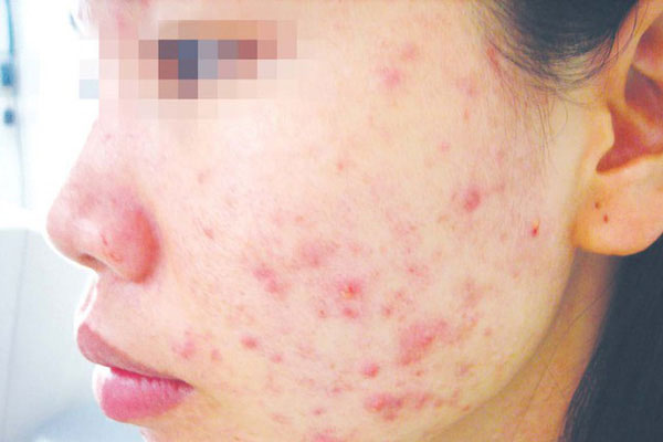 Tin chấn động với các tín đồ skincare: Thu giữ kho hàng mỹ phẩm giả trị giá 48 tỉ đồng-9