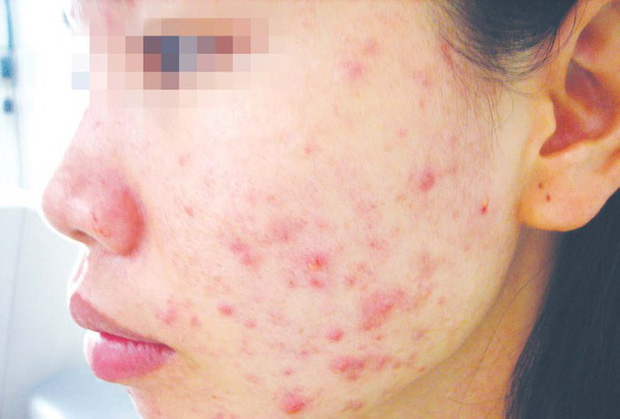 Sát Tết, lại khổ vì mỹ phẩm giả-1