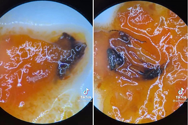 SỰ THẬT về tương ớt vỉa hè khi được soi dưới kính hiển vi: Chứa cả xác động vật, vô vàn vi khuẩn bơi tưng bừng khiến người xem hú hồn hú vía!-2