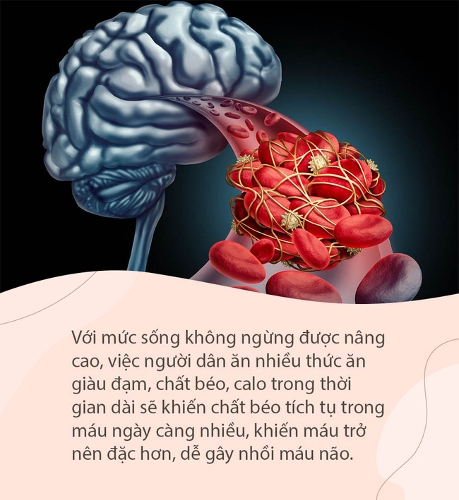 Khi mạch máu não bị tắc nghẽn, sẽ có 4 biểu hiện này ở bàn chân, chú ý để phòng tránh đột quỵ bất ngờ-1