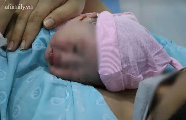 BV Hoàn Mỹ Đà Lạt lên tiếng về vụ sản phụ tử vong sau sinh mổ: Bệnh nhân suy thai, rối loạn đông máu trước khi chết-2