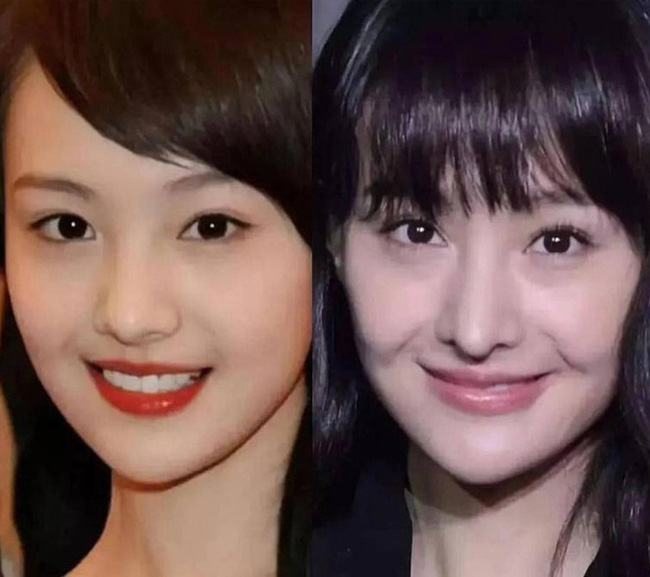 Sự thật về Nữ thần thanh xuân Trịnh Sảng: Nghiện thẩm mỹ, phát ngôn thiếu suy nghĩ, thuê người mang thai hộ và đỉnh điểm là vứt bỏ luôn 2 con sơ sinh-2