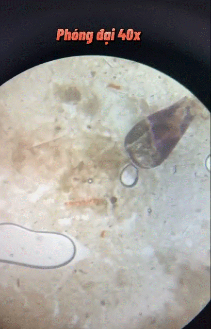 Clip triệu view soi mắm tôm dưới kính hiển vi, nhiều dị vật kỳ lạ bơi ngoe nguẩy: Chuyên gia cảnh báo những lưu ý để tránh ngộ độc, nhiễm khuẩn-3