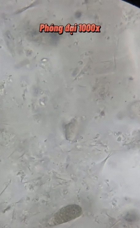 Clip triệu view soi mắm tôm dưới kính hiển vi, nhiều dị vật kỳ lạ bơi ngoe nguẩy: Chuyên gia cảnh báo những lưu ý để tránh ngộ độc, nhiễm khuẩn-4