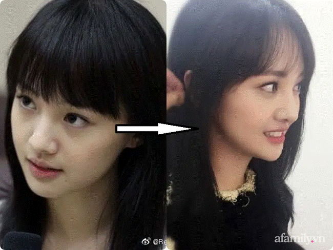 Trịnh Sảng: Từ nàng Cỏ trong sáng thuần khiết đến mỹ nhân vì tình mà dao kéo nát mặt-5