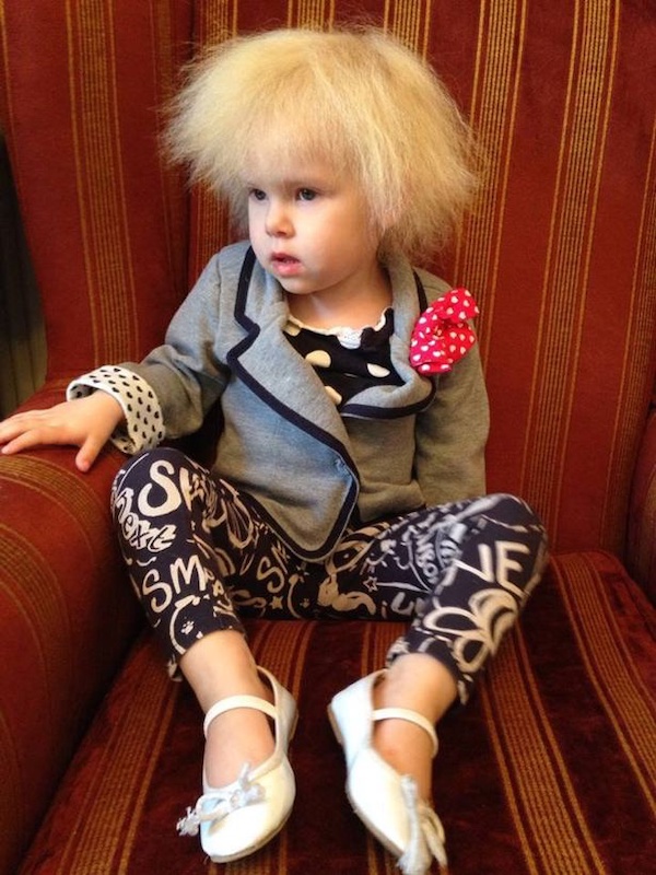 Bé gái sở hữu mái tóc kì lạ khiến mẹ khổ sở vì không thể chải theo ý muốn, diện mạo khi lớn lên ai cũng bất ngờ-1