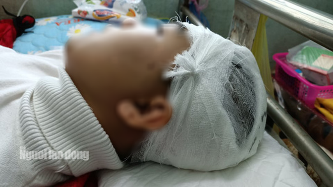 Nam sinh lớp 11 bị bạn cùng trường dùng gậy sắt đánh vỡ sọ não?-1