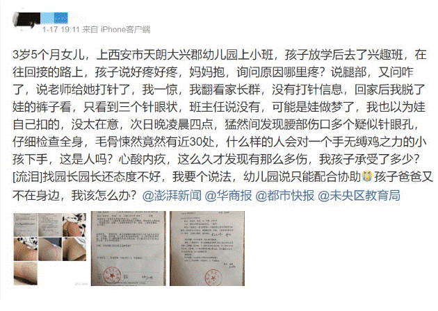Phát hiện con gái 3 tuổi có gần 30 vết kim đâm trên cơ thể, mẹ điên tiết gọi cô giáo thì nhận được lời giải thích hoang đường-2
