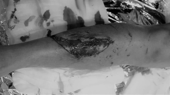 Kinh hoàng: Chó Pitbull nặng 40kg nổi điên tấn công liên tiếp 2 người nhập viện-2