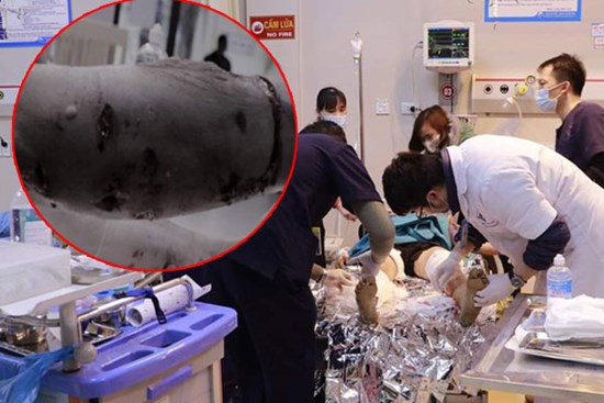 Kinh hoàng: Chó Pitbull nặng 40kg 
