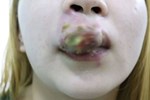 Từ chuyện bé 5 tuổi phun môi collagen: Phun xăm môi cho trẻ em dẫn đến những hệ lụy gì?-7