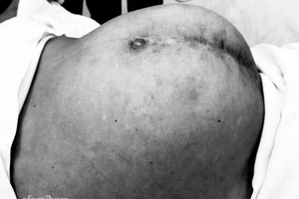 Đây là 3 loại nước chấm vô cùng nguy hiểm nhiều người vẫn vô tình ăn, nếu không cẩn trọng thì bệnh ung thư có thể tìm-4