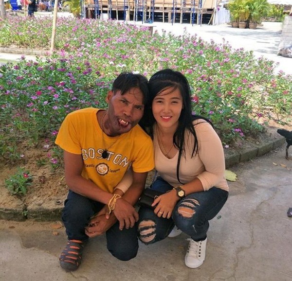 Chàng trai mặt quỷ nên duyên, thề non hẹn biển với người vợ xinh đẹp giờ có cuộc sống ra sao sau 2 năm?-1