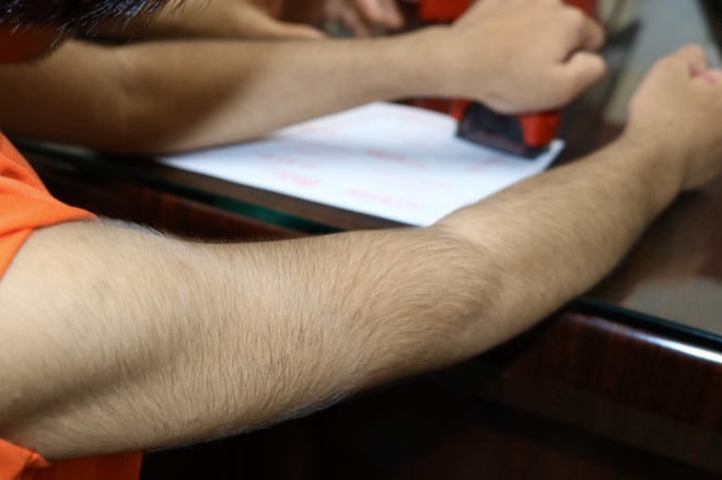 Ăn kim loại, loét da toàn thân và những căn bệnh lạ ở Việt Nam-2