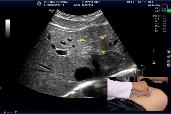 Chồng suốt ngày khiến vợ ngứa mắt” khi mang bầu, con vừa ra đời đã có điệu lườm nguýt y chang mẹ, các bố xem mà rút kinh nghiệm-13