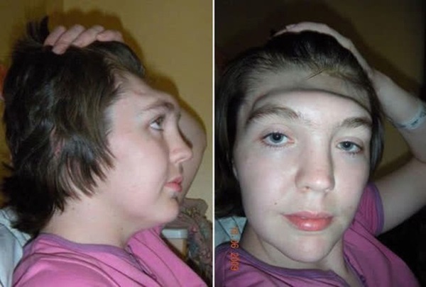 Cô gái bị mất cả trán vì dáng ngồi sang chảnh trên xe ô tô mà nhiều con nghiện sống ảo vẫn thường xuyên pose ảnh mỗi ngày-3