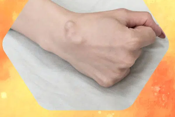 Căn bệnh khiến bé 7 tuổi đột ngột mất tiếng, liệt dần tứ chi-2