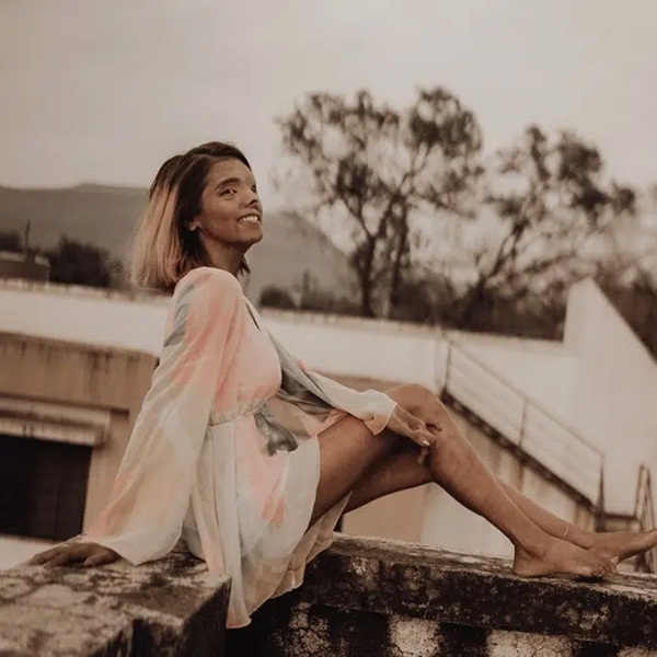 Bé gái 2 tháng tuổi bị cha tạt axit vì không phải là con trai, tưởng không sống được bao lâu nào ngờ 26 năm sau có cuộc đời đáng kinh ngạc-1