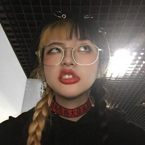 3 kiểu người dễ bị nhồi máu não từ khi còn trẻ, kiểm tra ngay để sửa đổi càng sớm càng tốt-1