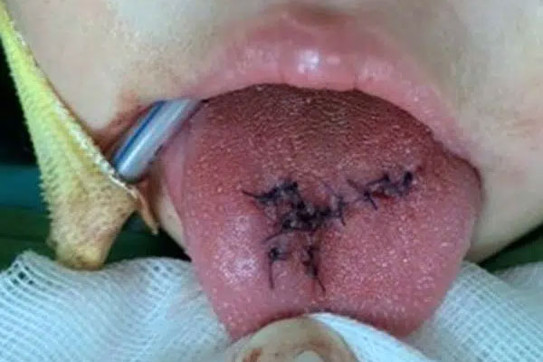 Tìm ra thủ phạm gây lão hóa da, chính là loại gia vị này, phụ nữ càng ăn nhiều càng già đi nhanh-8