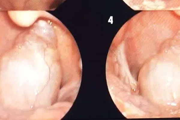11 bí quyết để ăn Tết không tăng cân, đặc biệt điều số 10 ít ai để ý-6