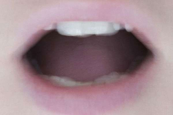 Bé gái 8 tuổi ở TP.HCM tái dương tính SARS-CoV-2 sau khi xuất viện được đưa đi cách ly cùng mẹ-4