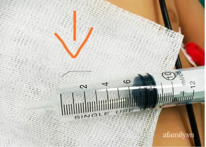 Đang ăn dặm, bé 8 tháng tuổi bỗng nôn ói và khóc dữ dội, thủ phạm chính thứ nhà nào cũng dùng-3