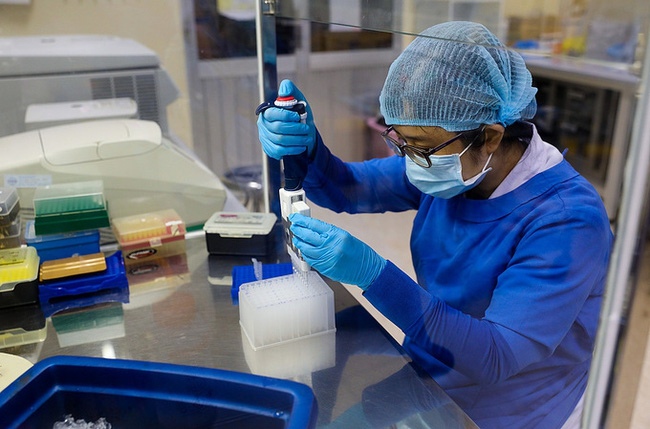 Hiện tượng bí ẩn đáng lo ngại của những bệnh nhân sau khi điều trị khỏi Covid-19-6