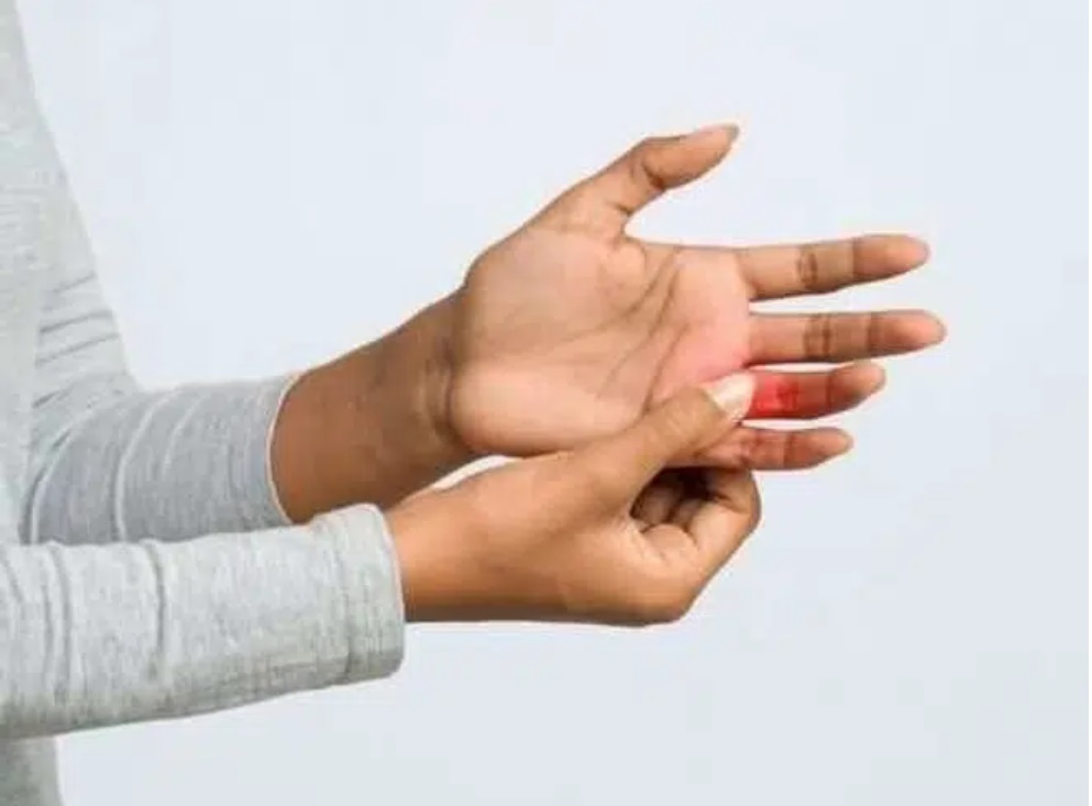 Xuất hiện 3 triệu chứng mới là dấu hiệu ban đầu mắc COVID-19-3