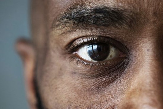 Phát hiện triệu chứng mới ở nhiều người nhiễm biến chủng SARS-CoV-2