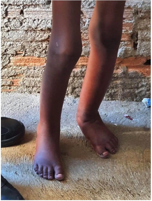 Giải cứu bé trai bị cha đẻ xích trong thùng kim loại, bỏ đói nhiều ngày phải ăn cả chất thải, câu đầu tiên em thốt ra gây nhói lòng-3