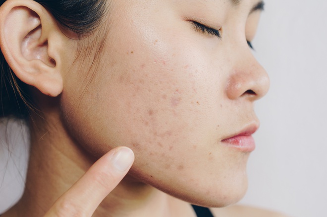 Làn da của bạn sẽ ra sao khi đi ngủ không tẩy trang?-4