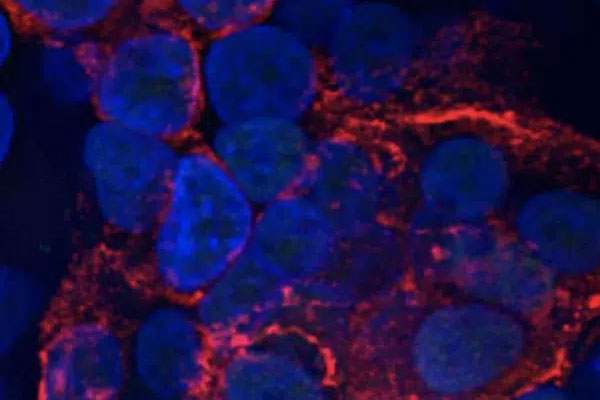 Gia Lai phát hiện ca dương tính SARS-CoV-2 thứ 14, ra thông báo khẩn tìm người đến nhiều địa điểm-2