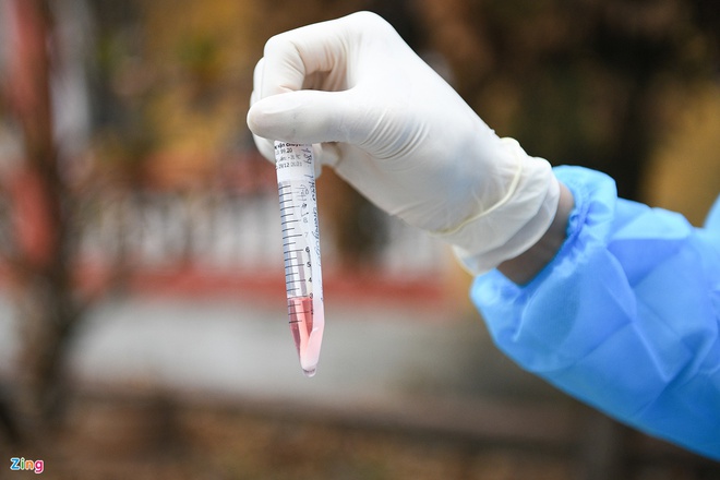 Tiếp xúc F0, 2 nữ nhân viên karaoke dương tính với Covid-19-1