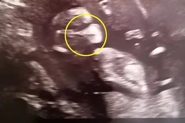 Bà mẹ sốc nặng khi lần đầu tiên gặp con, còn ê-kíp đỡ sinh thì kinh ngạc vì bác sĩ đã siêu âm sai-4