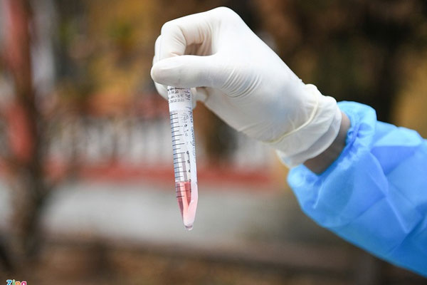 Triệu chứng phổ biến ở người nhiễm SARS-CoV-2 tại Việt Nam-1