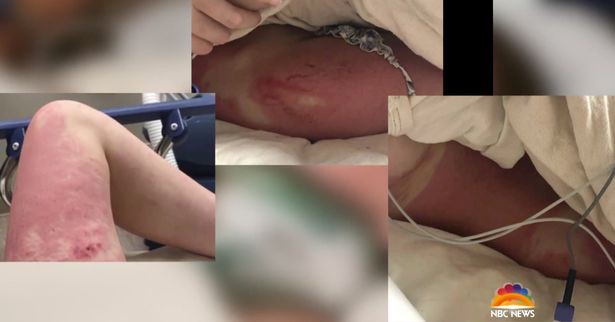 Đẩy bạn thân từ độ cao 20m xuống nước cho vui suýt gây tai nạn chết người, cô gái trẻ nhận cái kết tù tội và cuộc sống hiện tại của nạn nhân-2