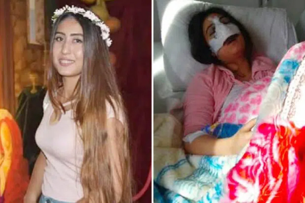 Đi nâng mũi cho thon gọn, nữ sinh viên bỗng nôn ra máu và đau bụng dữ dội đến chết, bác sĩ phẫu thuật đưa ra lý do gây choáng-1