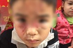 Tâm sự xót xa của bố đẻ bé gái 12 tuổi nghi bị mẹ và người tình bạo hành dã man ở Hà Nội-7