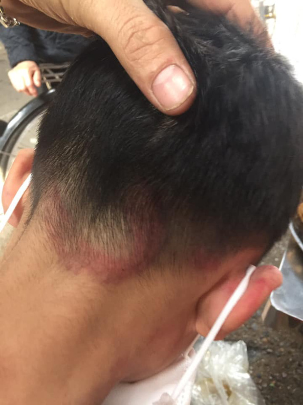 Hình ảnh cháu bé bị bố ruột bạo hành, đánh đập dã man tại Hà Nội khiến dân mạng phẫn nộ-3