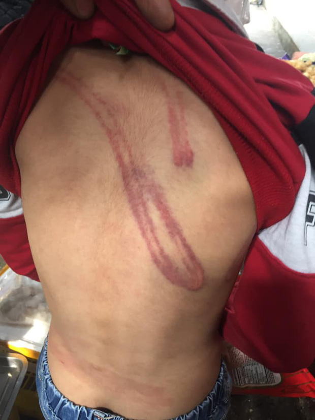 Hình ảnh cháu bé bị bố ruột bạo hành, đánh đập dã man tại Hà Nội khiến dân mạng phẫn nộ-4