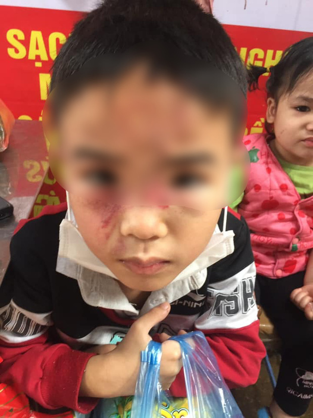 Hình ảnh cháu bé bị bố ruột bạo hành, đánh đập dã man tại Hà Nội khiến dân mạng phẫn nộ-2