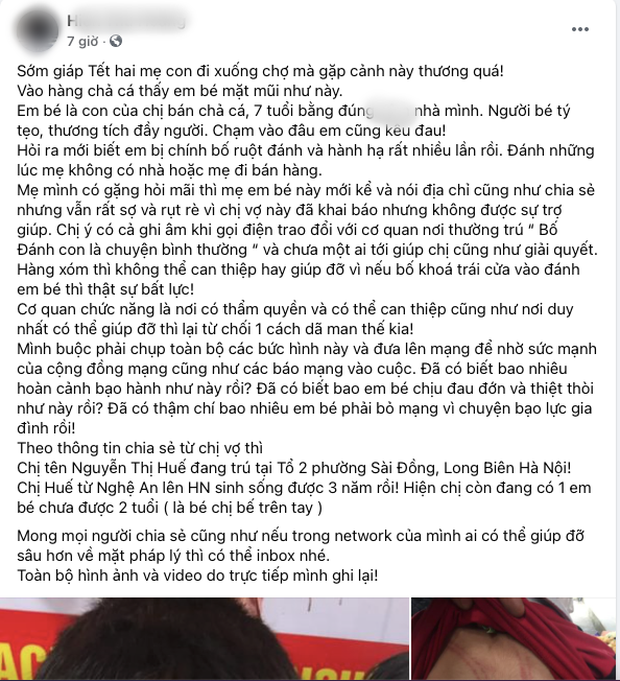 Hình ảnh cháu bé bị bố ruột bạo hành, đánh đập dã man tại Hà Nội khiến dân mạng phẫn nộ-1