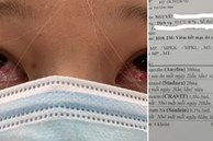 Đeo kính áp tròng làm đẹp dịp Tết, cô gái trẻ 'ngậm trái đắng' khi phải đến viện điều trị viêm giác mạc
