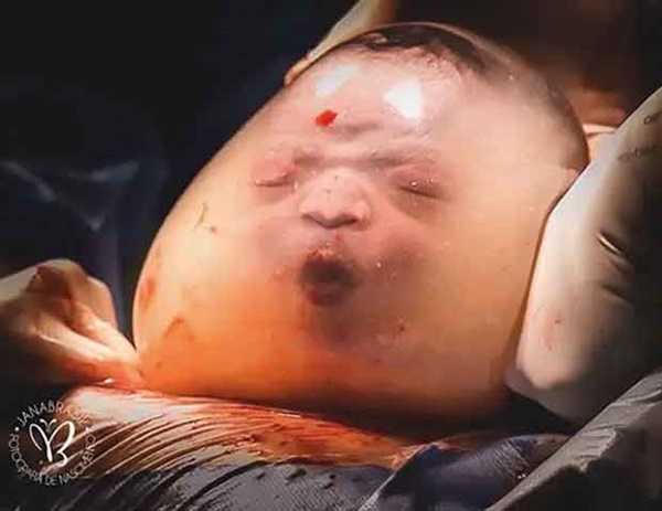 Bé trai trong bức ảnh sinh ra vẫn đang nằm nguyên trong túi ối” từng gây chấn động thế giới vài năm trước giờ ra sao?-1