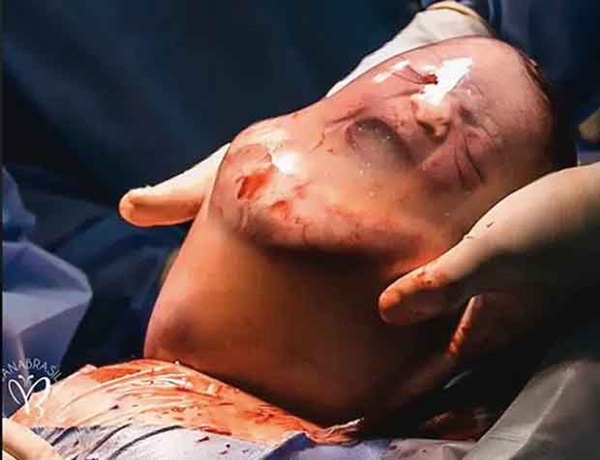 Bé trai trong bức ảnh sinh ra vẫn đang nằm nguyên trong túi ối” từng gây chấn động thế giới vài năm trước giờ ra sao?-3