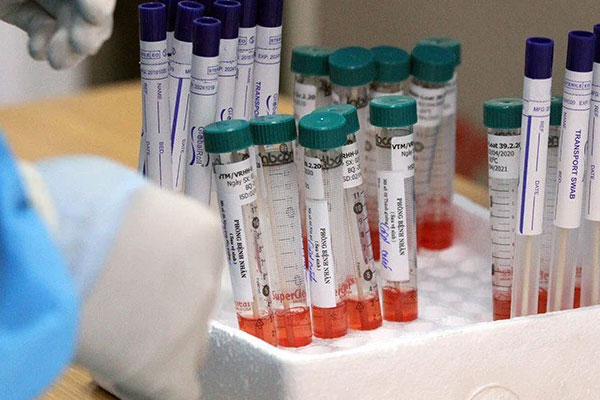 TP.HCM mở đợt cao điểm xét nghiệm Covid-19 trong cộng đồng-2