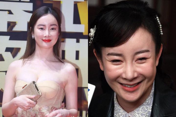 Trịnh Sảng và những mỹ nhân Hoa ngữ thừa nhận thẩm mỹ hỏng-5