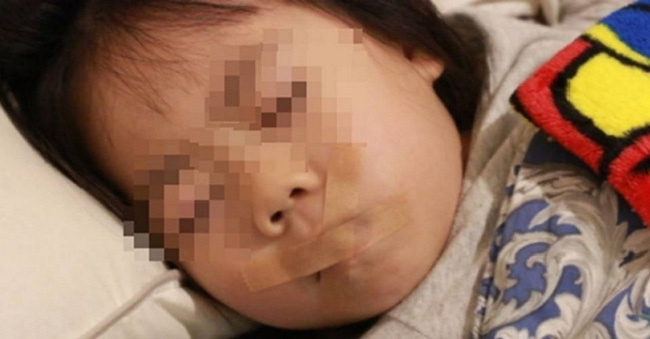 Bà mẹ dán băng dính vào miệng con khi bé ngủ, ai cũng mắng té tát nhưng bác sĩ lại nói rằng cô làm đúng-1